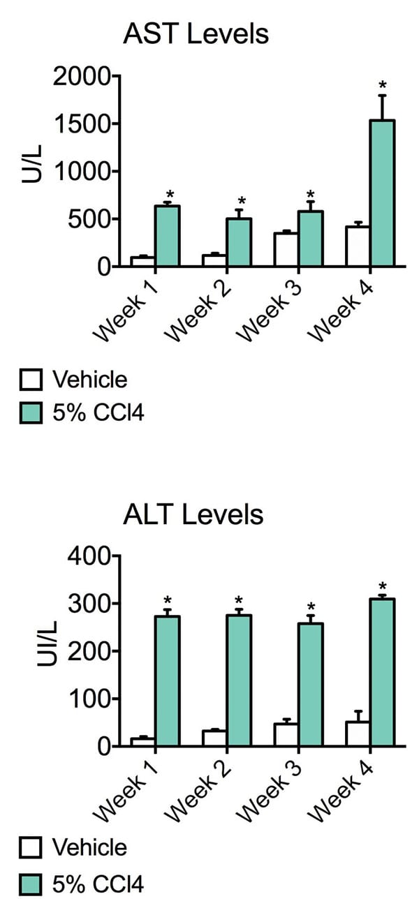 Liver Fibrosis Models show liver damage as the graph shows AST and ALT levels significantly elevated in CCl4 administered animals