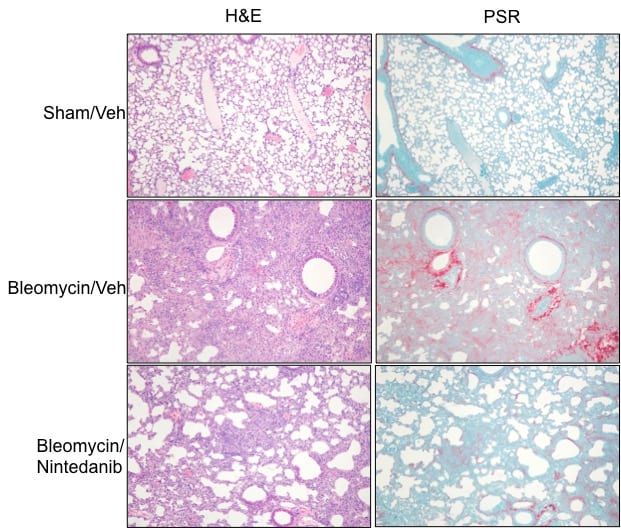 Staining images show significant increases in both interstitial fibrosis and inflammation in the lung samples of Bleomycin/Vehicle group