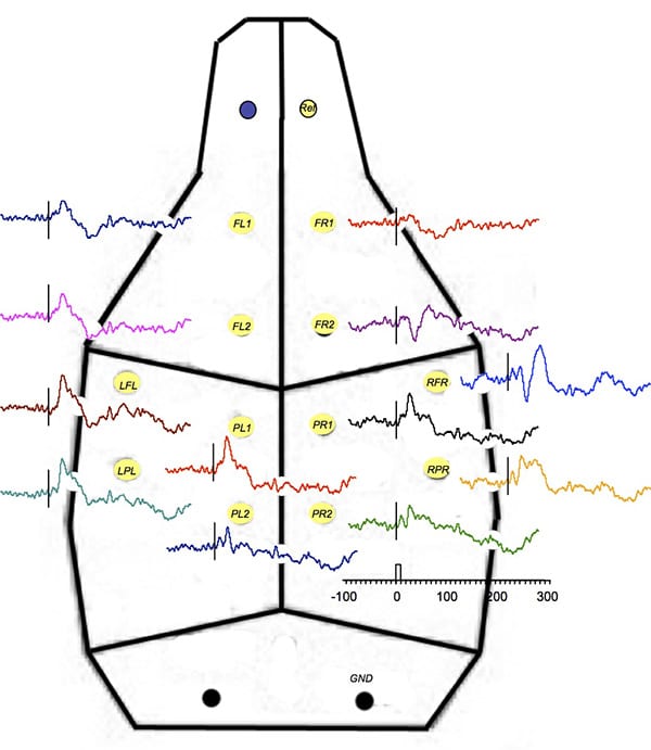 Average evoked potentials implanted with 12 separate chronic supra-dural electrodes using a common reference over the olfactory bulb.